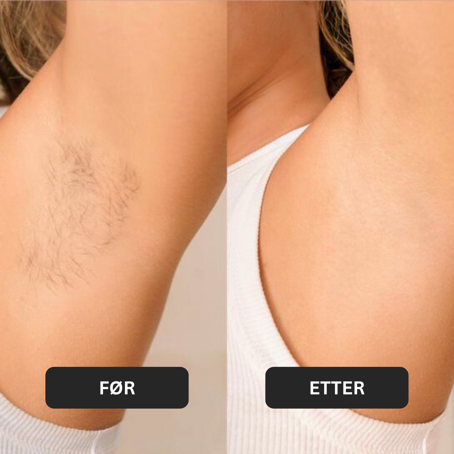 Sugaring hårfjerningspasta