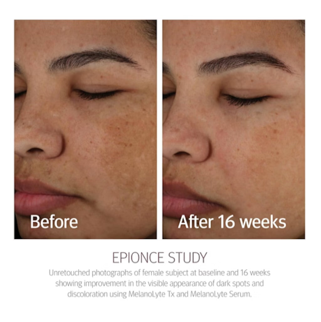 Epionce Melanolyte TX 30 ml