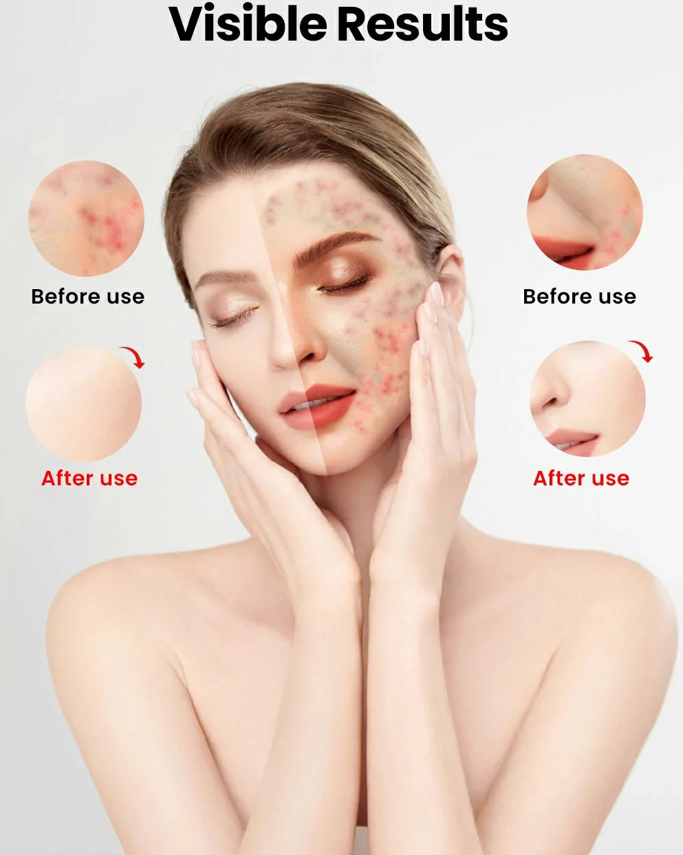 Uno Vita`s Advanced Beauty LED Light Therapy Facemask TLM200-K 510