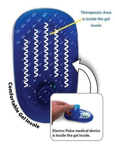 ActiPatch Smart Insole