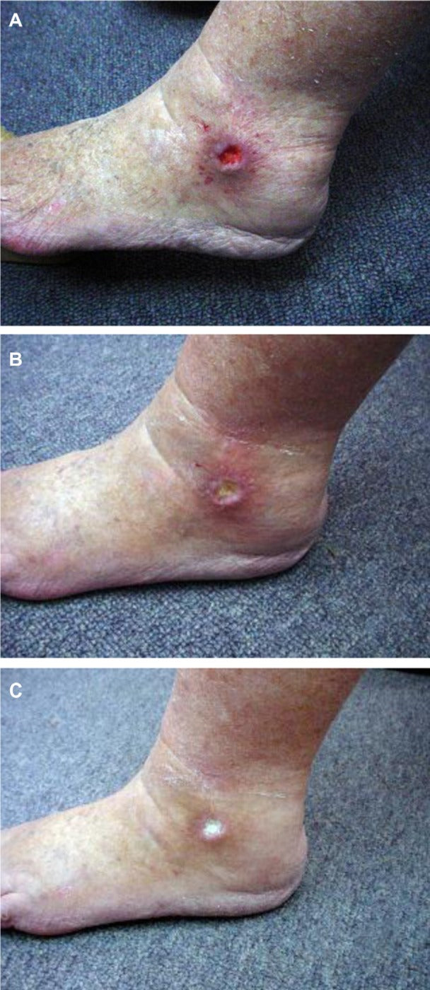 Earthing High-Silver Fitted Grounding Sheet (140x200cm)