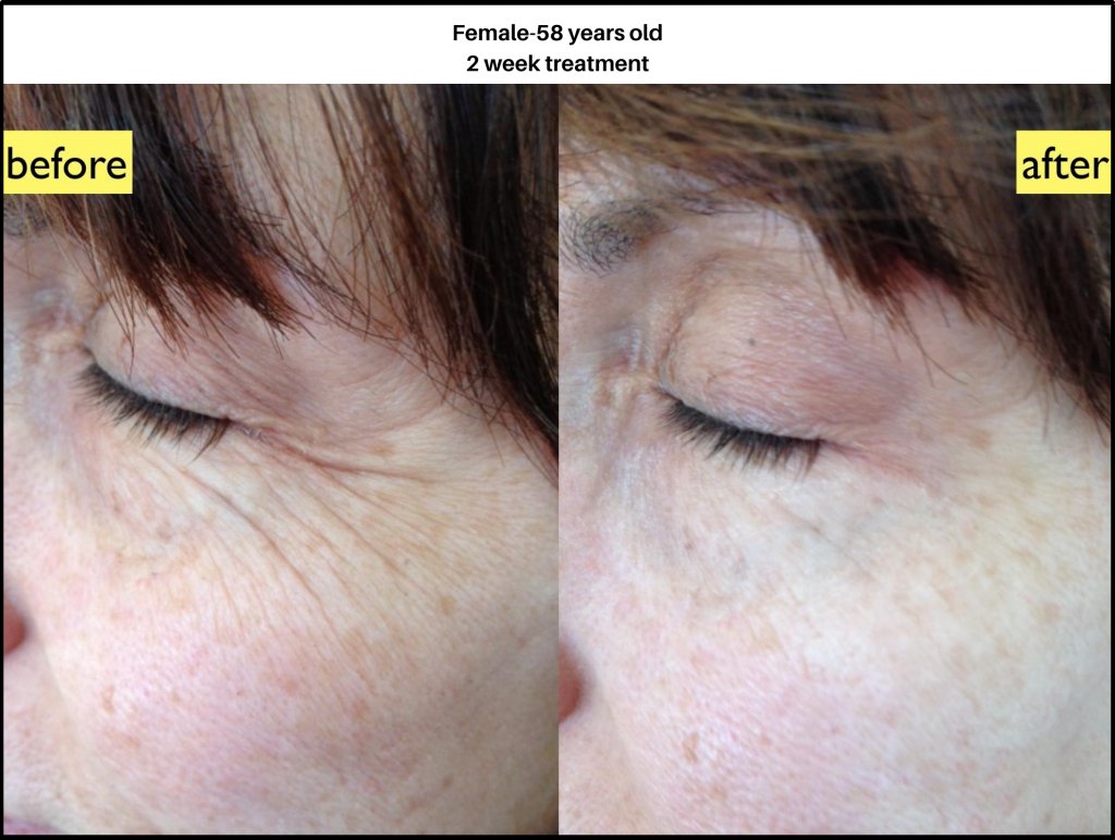 Nano Soma Natural Skin Cream