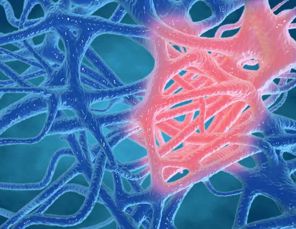 Purovitalis Liposomal Quercetin