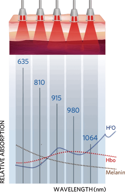 Smart Ice Class 4 Laser Therapy System (Class IV profesjonell laser terapi)