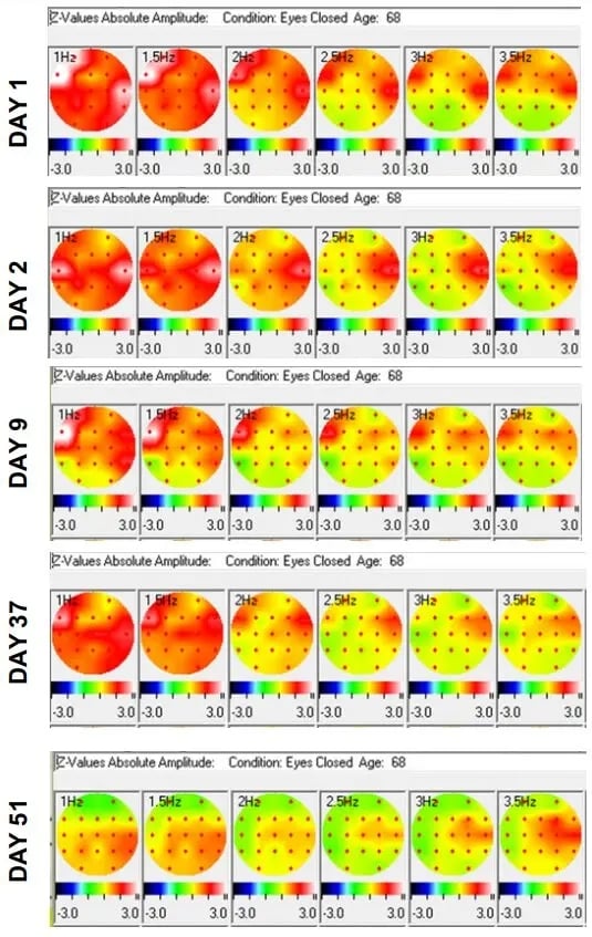 The Analemma Wand (luxury walnut)