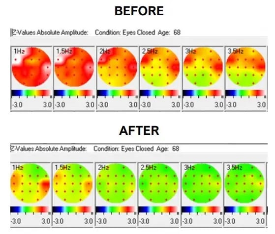 The Analemma Wand (luxury walnut)