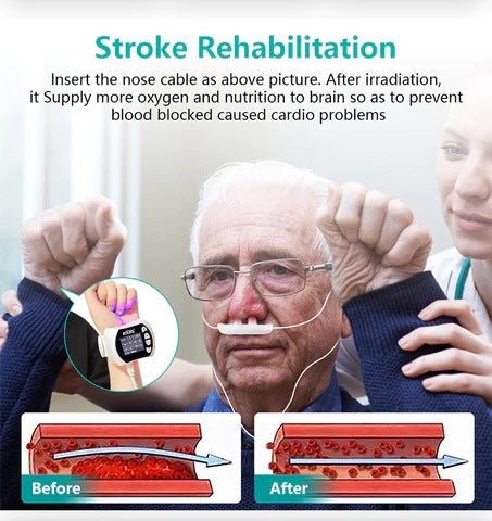 Uno Vita 4 Color Laser (LLLT) therapy Watch