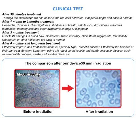 Uno Vita 4 Color Laser (LLLT) therapy Watch