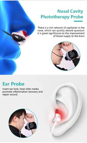 Uno Vita 4 Color Laser (LLLT) therapy Watch