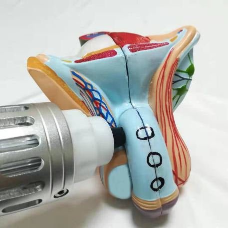 Uno Vita Focus Shockwave System (ED)