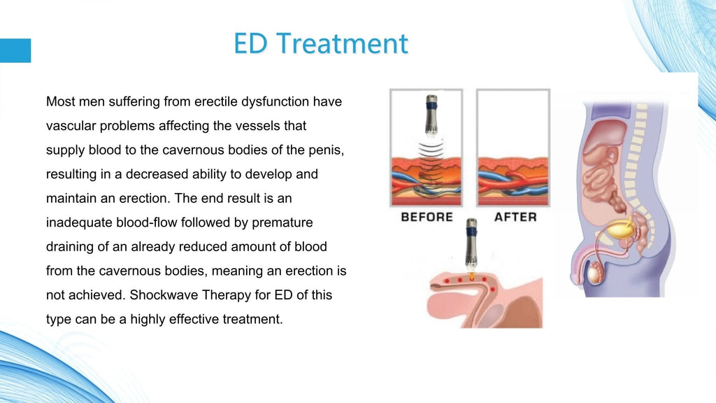 Uno Vita Focus Shockwave System (ED)