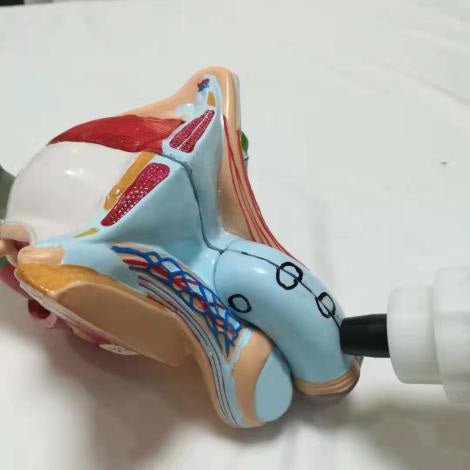 Uno Vita Focus Shockwave System (ED)