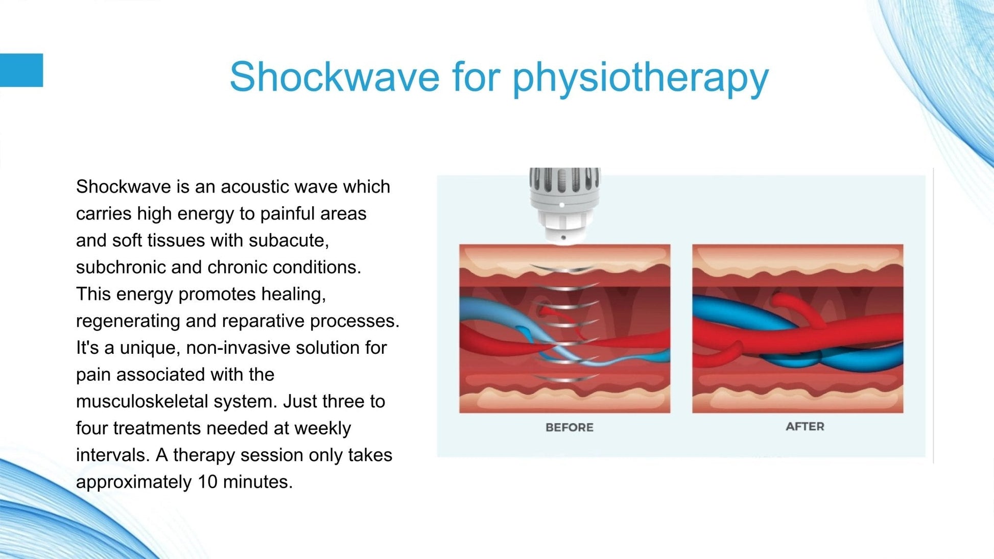 Uno Vita Focus Shockwave System (ED)