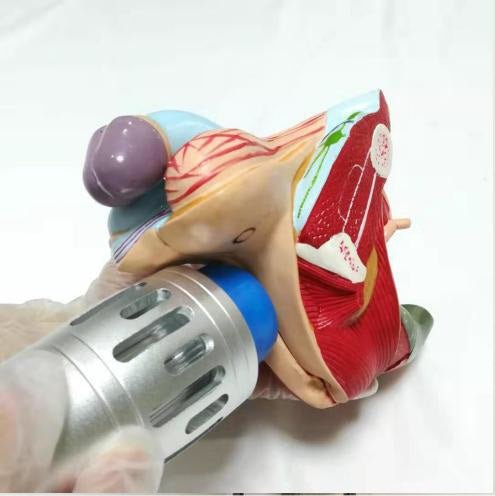 Uno Vita Focus Shockwave System (ED)