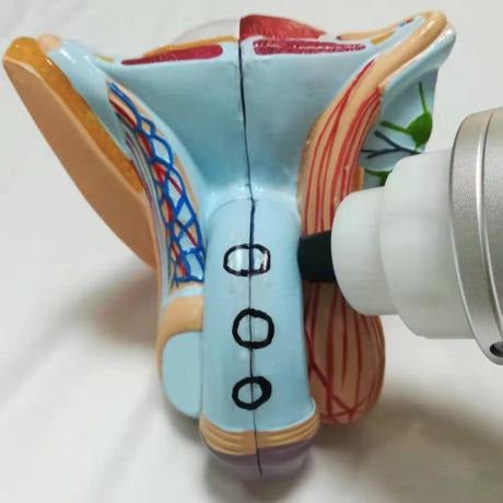 Uno Vita Focus Shockwave System (ED)