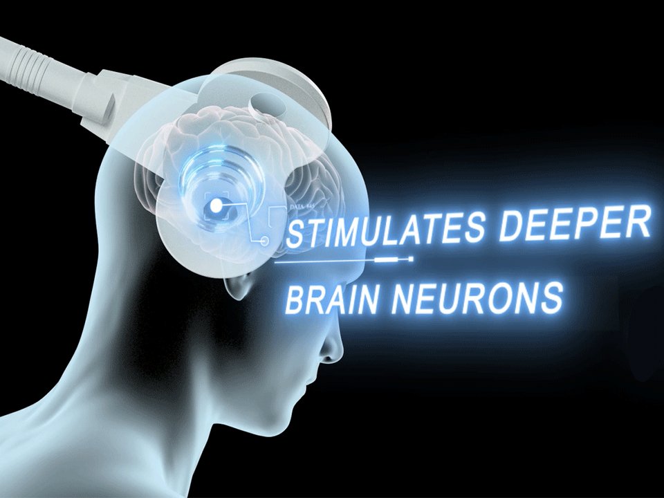 YINGCHI - rTMS (Transkraniell magnetisk stimulering)