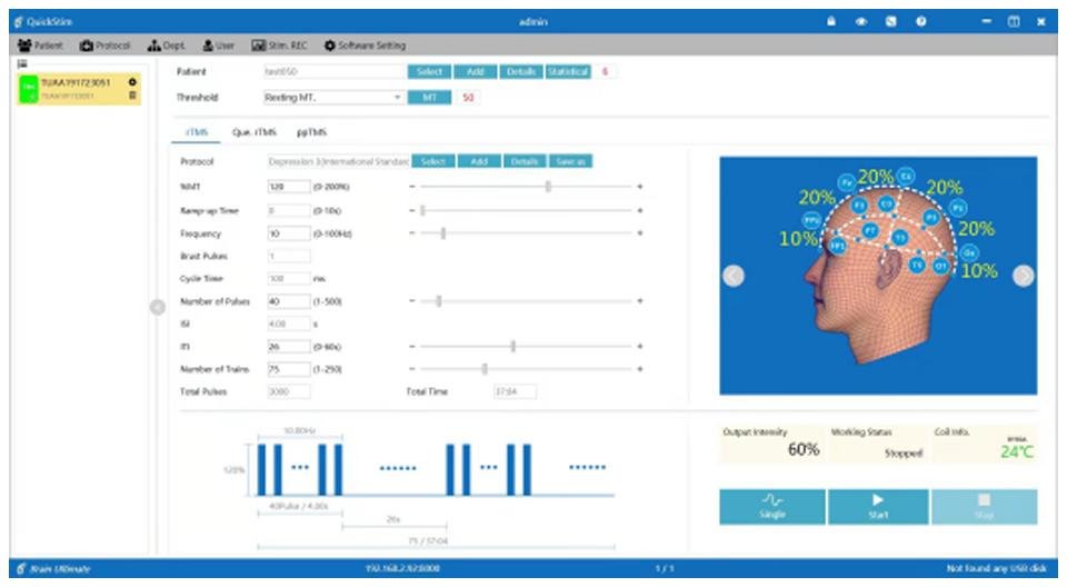 YINGCHI - rTMS (Transkraniell magnetisk stimulering)