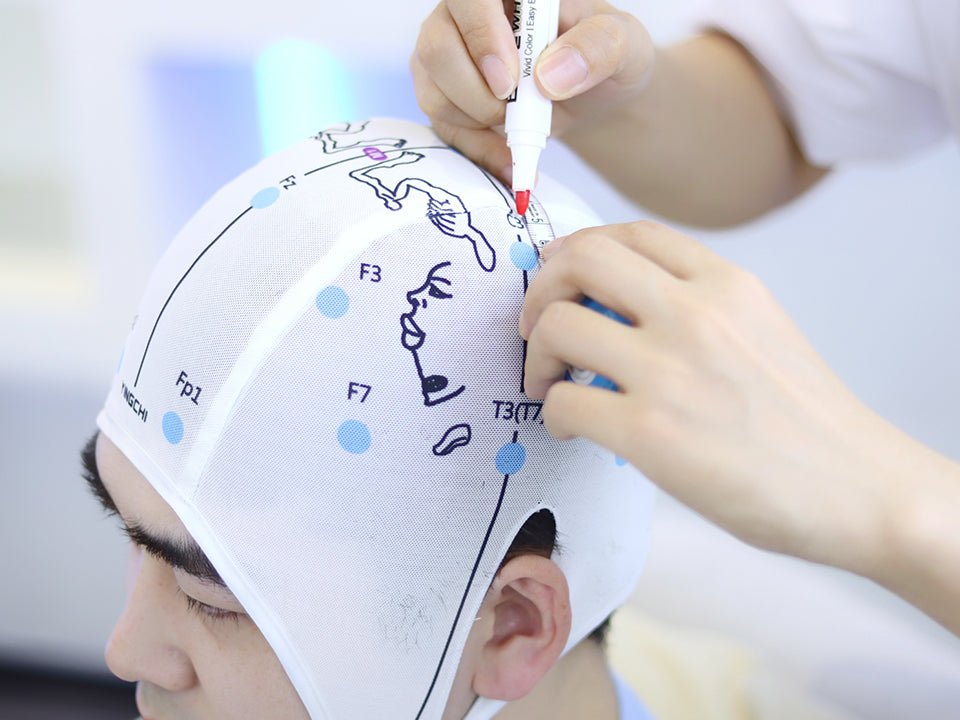 YINGCHI - rTMS (Transkraniell magnetisk stimulering)